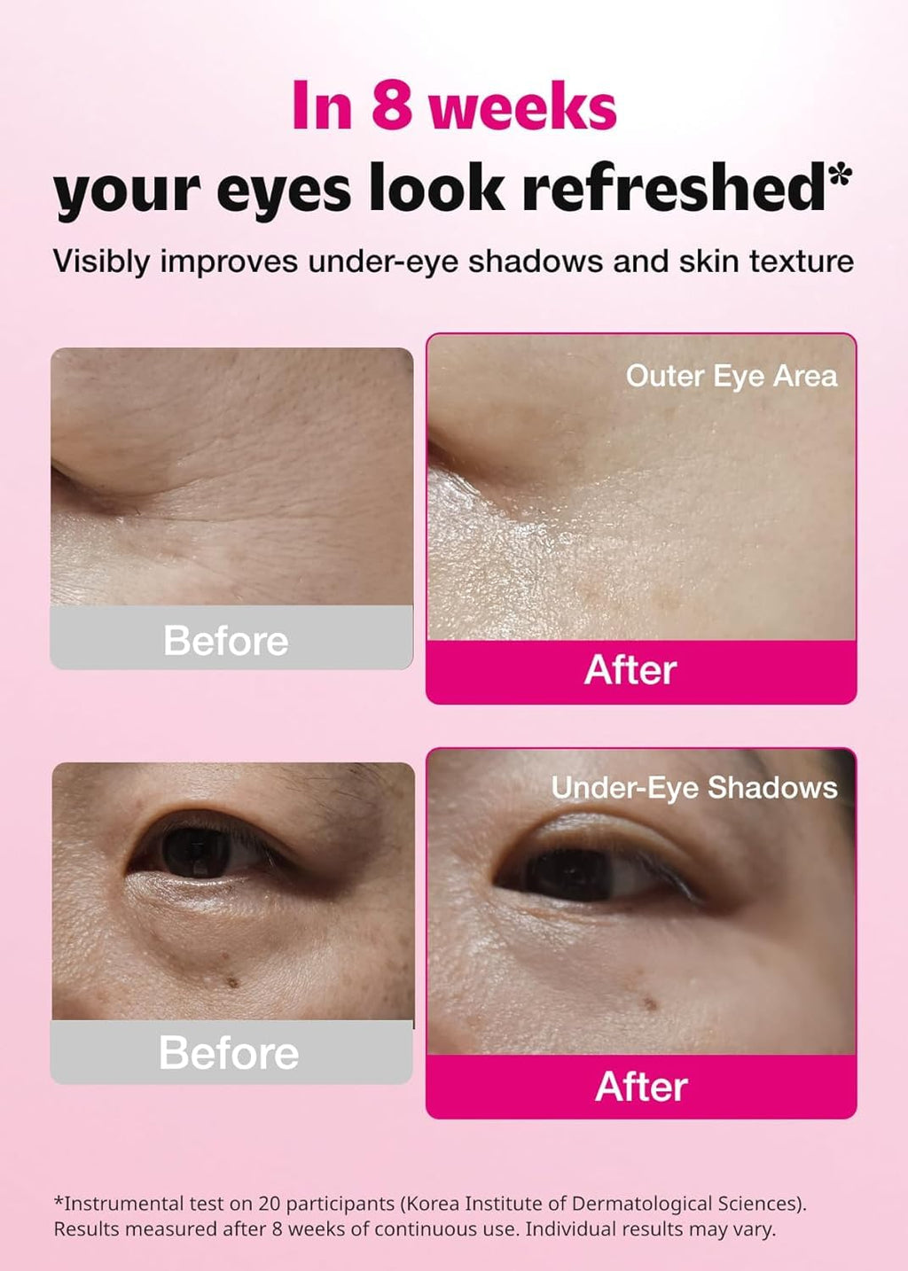 ISOI Blemish Care Eye Patches with Hyaluronic Acid, 90 Count | Dark Circles, Puffiness, Forehead & Smile Lines, Bulgarian Rose Oil