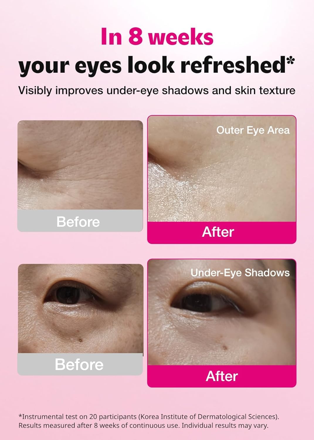 ISOI Blemish Care Eye Patches with Hyaluronic Acid, 90 Count | Dark Circles, Puffiness, Forehead & Smile Lines, Bulgarian Rose Oil