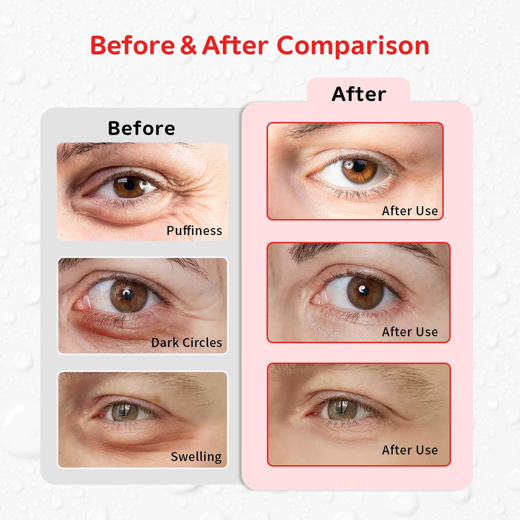 4PCS Gel Eye Ice Pack Set Reusable, Cold and Hot Compress for Eyes, Ice Pack for Eyes, Cooling Eye Pads for Eye Strain, Swelling, Redness, Dark Circles, Puffy Eyes, and Eye Recovery Surgery.