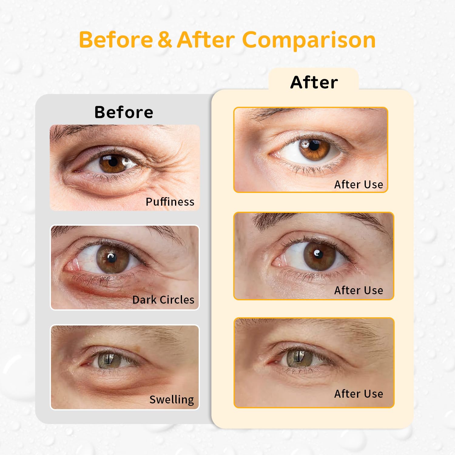 4PCS Gel Eye Ice Pack Set Reusable, Cold and Hot Compress for Eyes, Ice Pack for Eyes, Cooling Eye Pads for Eye Strain, Swelling, Redness, Dark Circles, Puffy Eyes, and Eye Recovery Surgery.