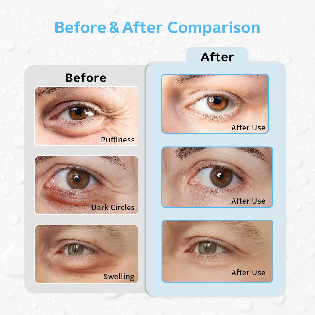 4PCS Gel Eye Ice Pack Set Reusable, Cold and Hot Compress for Eyes, Ice Pack for Eyes, Cooling Eye Pads for Eye Strain, Swelling, Redness, Dark Circles, Puffy Eyes, and Eye Recovery Surgery.