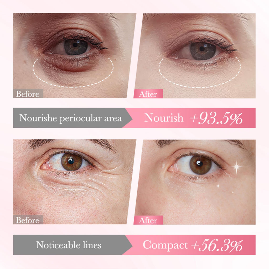 AKARY Eye Patches Rose Hydra-Gel Eye Mask Sheet Lady Skin Care Pad Remove Fine Lines Smooth Repair the Eyes Skin, Under Eye Gel for Moisturizing and Relieving, Firm the Look of the Eye Area