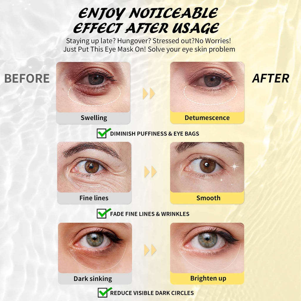 Maskiss PDRN Under Eye Patches (25 Pairs), Tri-Color Eye Gel Pads with Retinol Caffeine, Eye Masks for Dark Circles Puffy Eyes Wrinkles, Collagen Self Care Gifts for Women