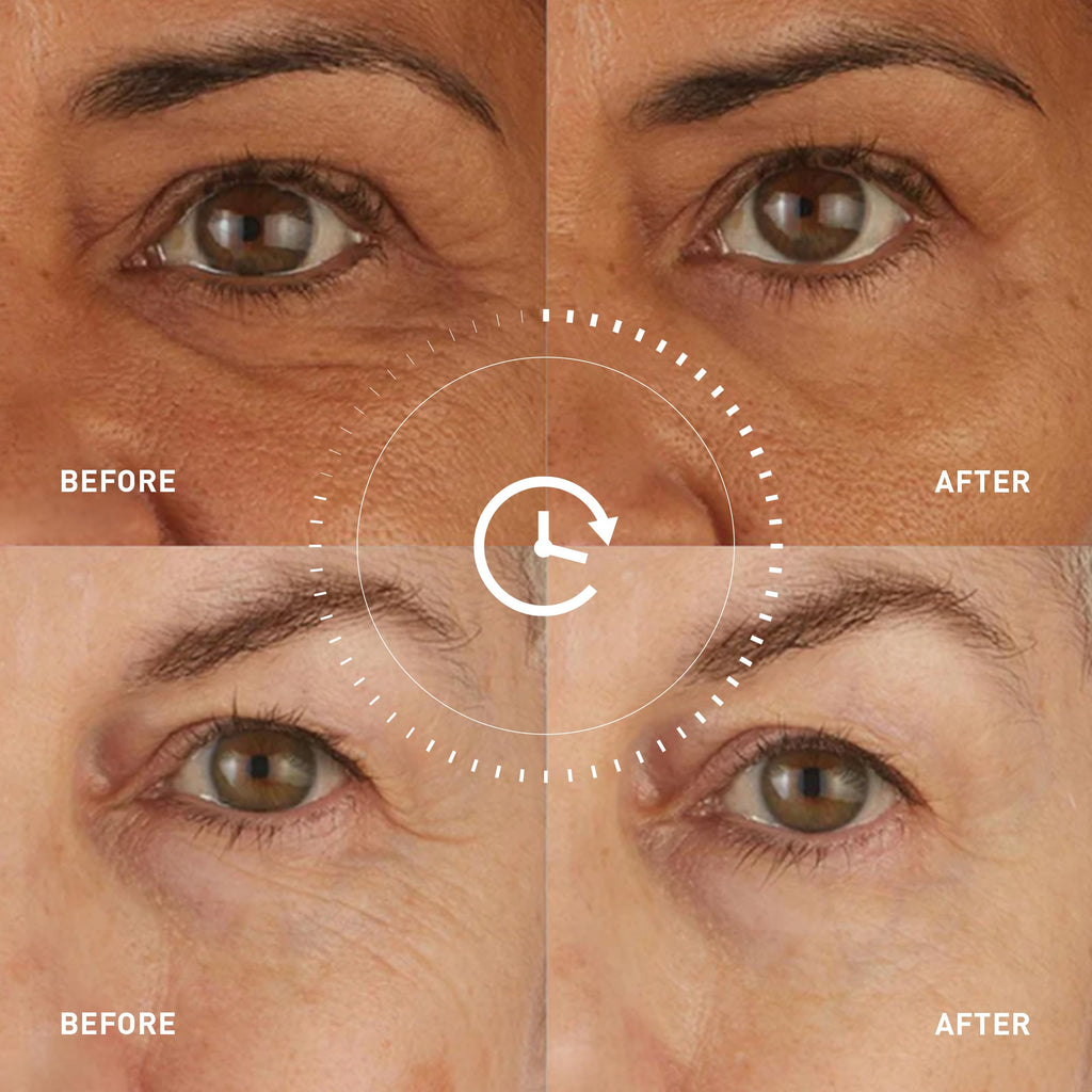 Skyn ICELAND Hydro Cool Firming Eye Patches For Puffy Eyes and Dark Circles