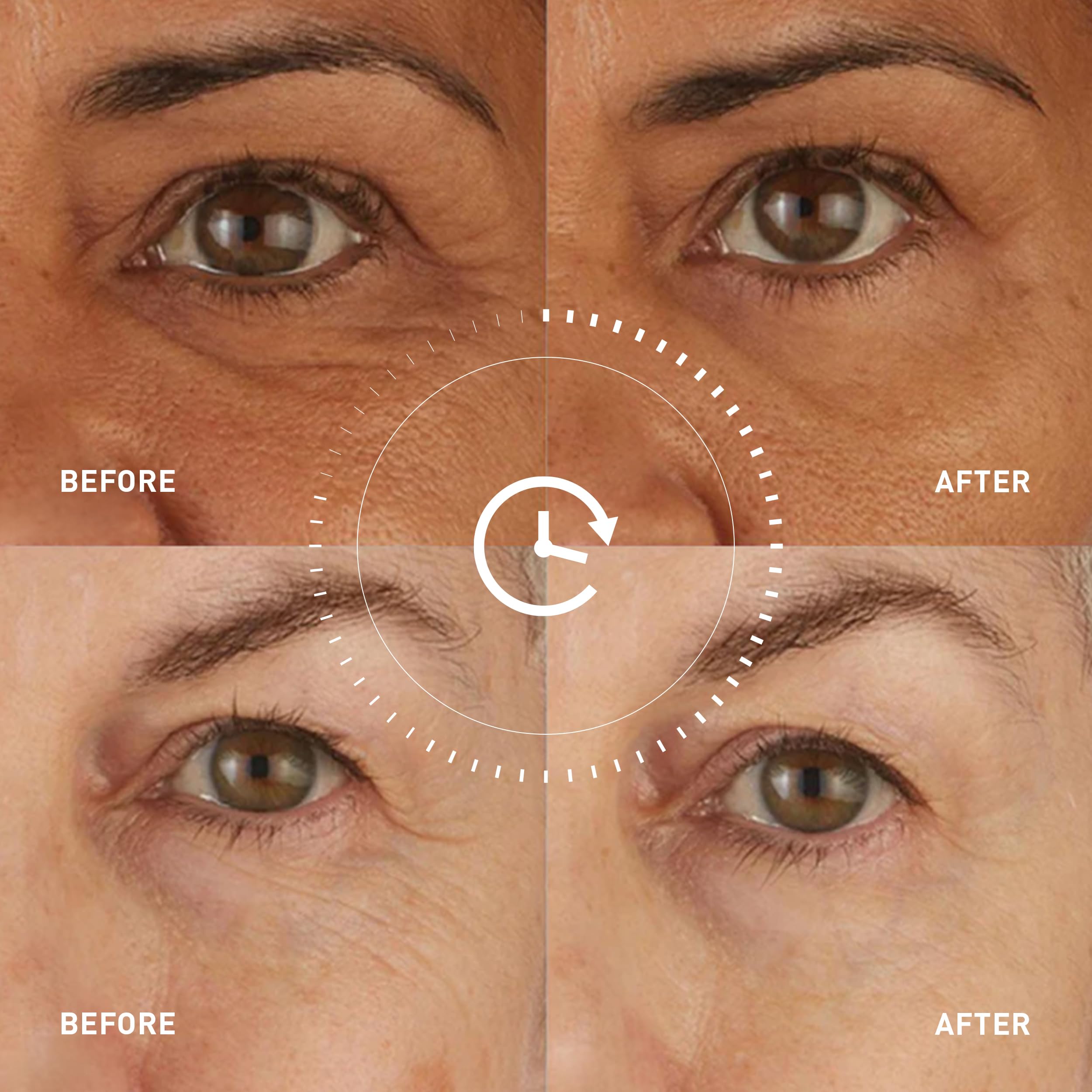 Skyn ICELAND Hydro Cool Firming Eye Patches For Puffy Eyes and Dark Circles