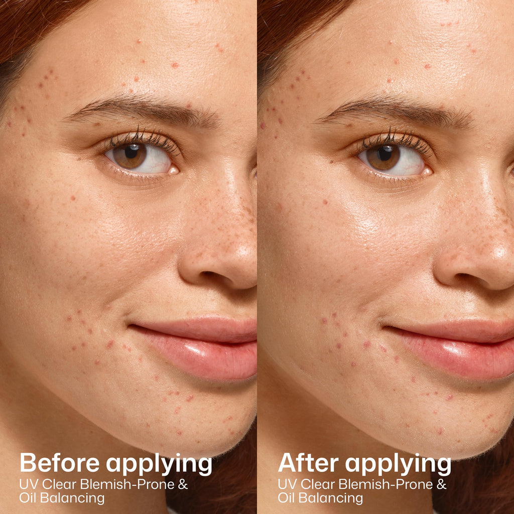 EltaMD UV Clear Face Sunscreen SPF, Oil-Free Sunscreen with Zinc Oxide, Dermatologist Recommended